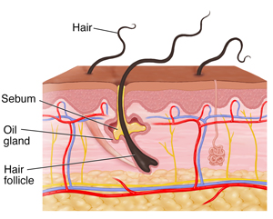 Cross section of skin showing hair follicle, oil gland and sebum.