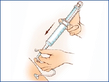 Imagen de una sonda de alimentación